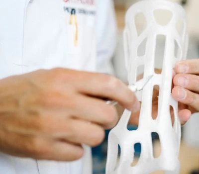 Izvoz formata STL datoteka za 3D ispisane ortoze: Kako 3D skeniranje stopala pretvara biomehaničk...